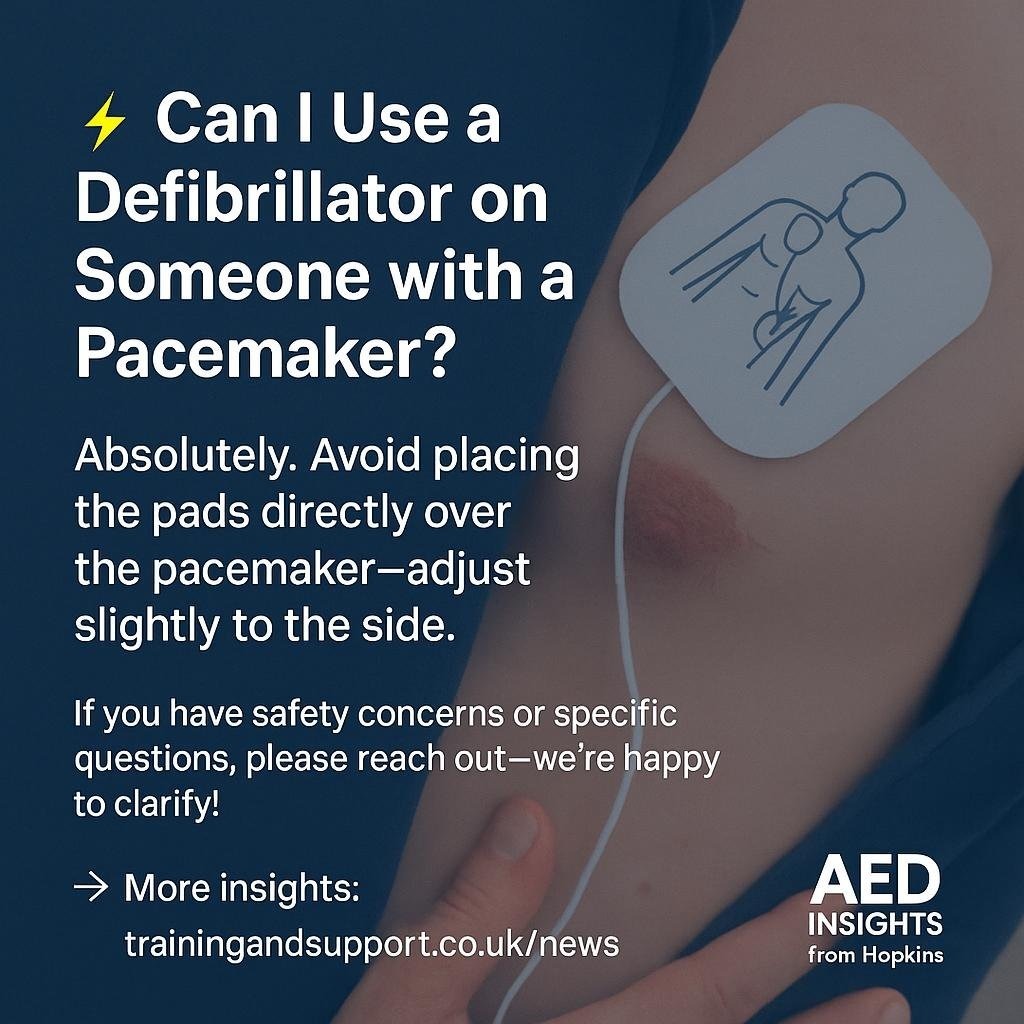 can-i-use-a-defibrillator-on-someone-with-a-pacemaker-gallery-original.jpeg